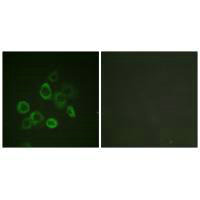 BAX (Ab-167) Antibody