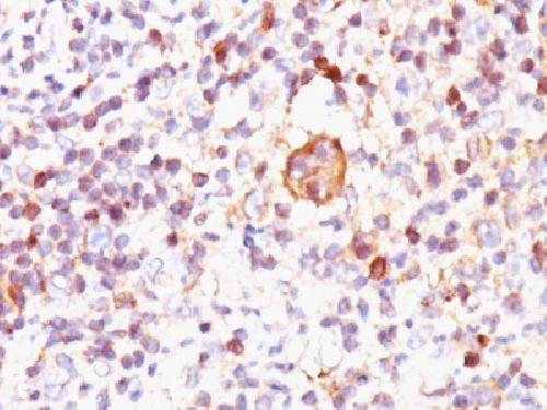 Bax (Apoptosis Marker) Antibody