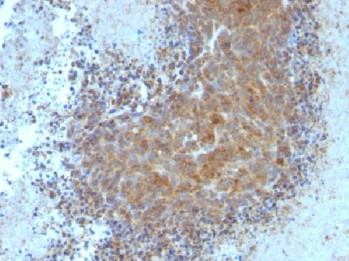 Bax (Apoptosis Marker) Antibody