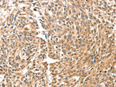 BAX Antibody