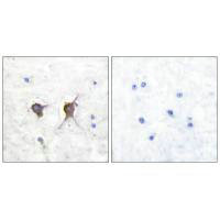 BAX Antibody