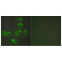 BAX Antibody