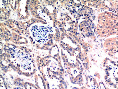BAX Monoclonal Antibody