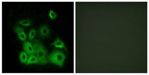 Bax (Phospho-Thr167) Antibody