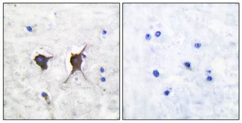 Bax Antibody