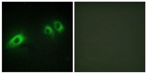 LAMB1 Antibody