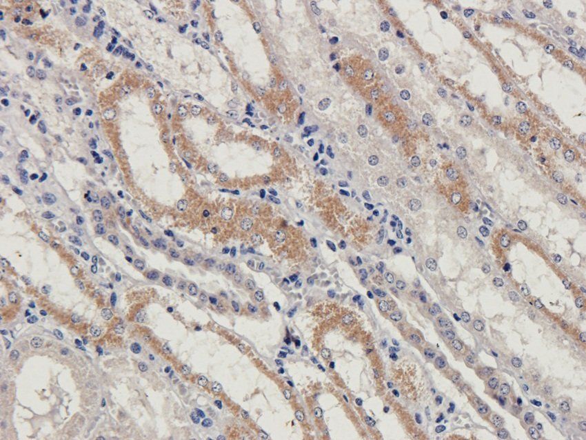 BAZ2A antibody