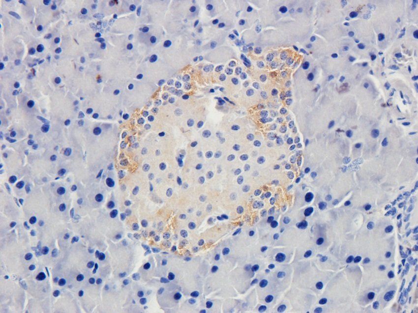 BAZ2A antibody
