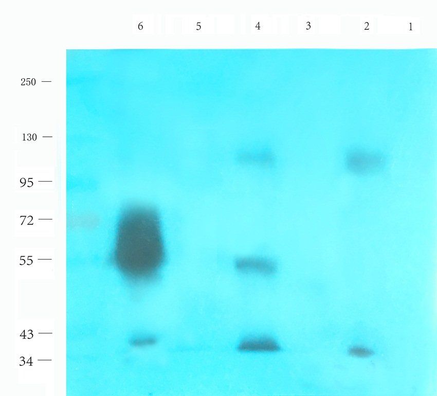 BAZ2A antibody