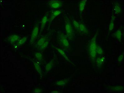 BAZ2B Antibody