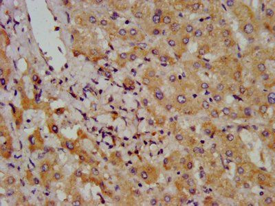 BAZ2B Antibody