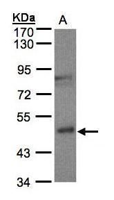 gamma-butyrobetaine hydroxylase 1 Antibody