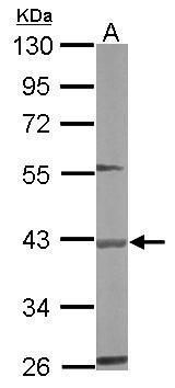 gamma-butyrobetaine hydroxylase 1 Antibody