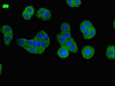 BBS1 Antibody