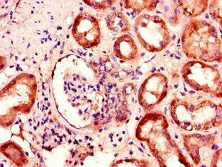 BBS1 Antibody