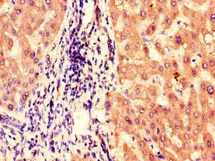 BBS1 Antibody