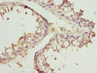 BBS2 Antibody