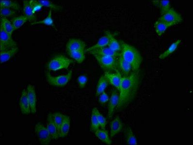 BCAM antibody