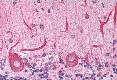 Goat anti-BCAP31 / BAP31 Antibody