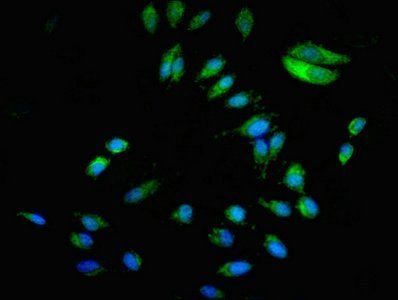 BCAR1 Antibody