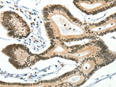 BCAS2 Antibody