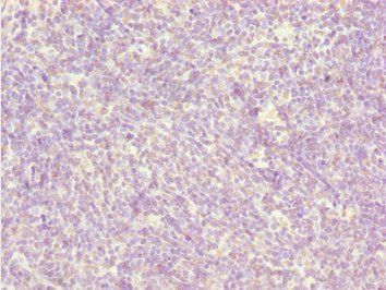 BCAS3 Antibody