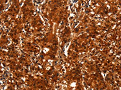 BCAS3 Antibody
