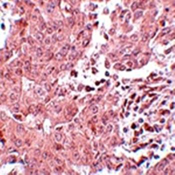 BCAS3 Antibody
