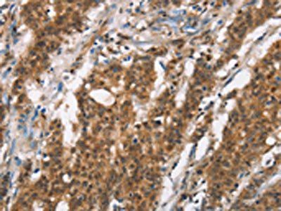 BCAS4 Antibody