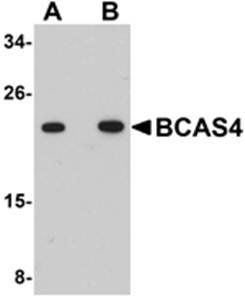 BCAS4 Rabbit Polyclonal Antibody