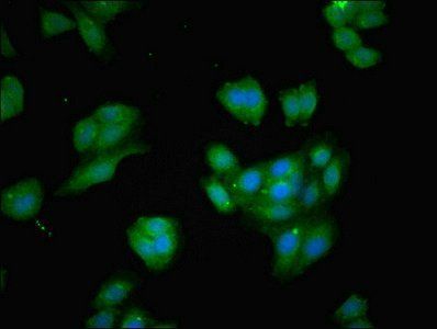 BCAT1 Antibody