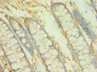 BCAT2 Antibody