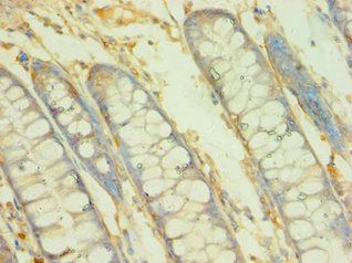 BCAT2 antibody