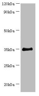 BCAT2 Antibody