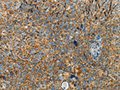 BCAT2 Antibody
