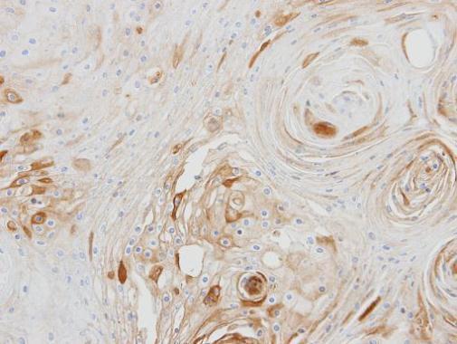 BCAT2 antibody
