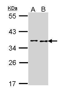 BRCA2 and CDKN1A interacting protein Antibody