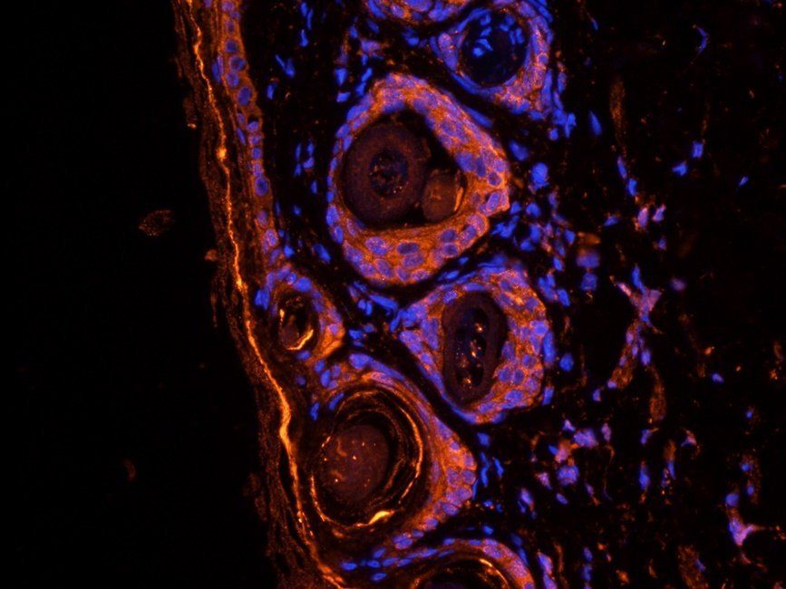 BCKDHA antibody