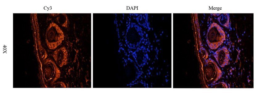 BCKDHA antibody