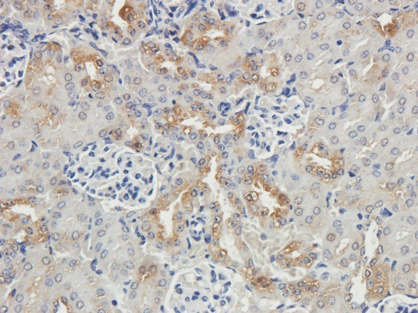 BCKDHA antibody