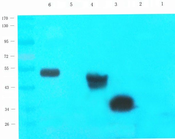 BCKDHA antibody