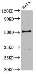 BCKDHA Antibody