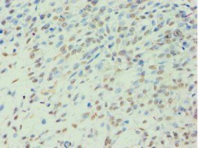 BCKDK Antibody
