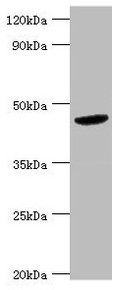 BCKDK antibody