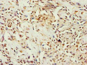 BCKDK Antibody