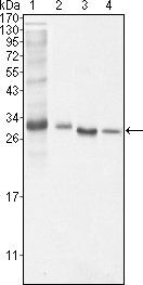 BCL-10 Antibody