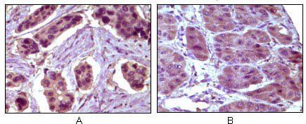 BCL-10 Antibody