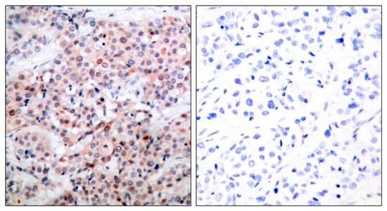 BCL-2(Phospho-Thr56) Antibody