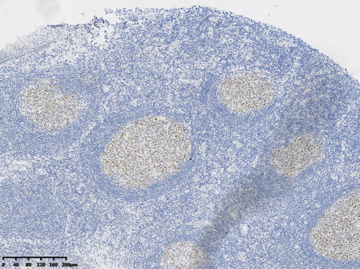 bcl 6 Antibody
