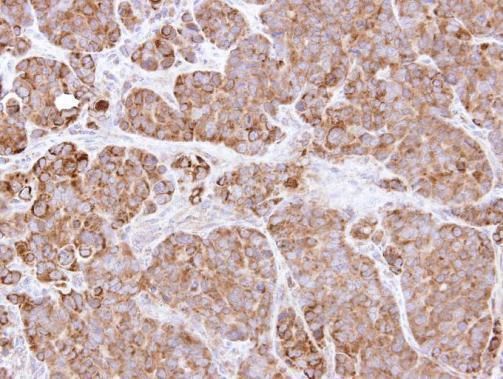 Bcl-X antibody